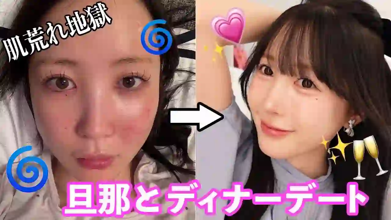 【Skin Trouble】Dinner makeup with my husband after a long time!! Pregnancy is difficult...。